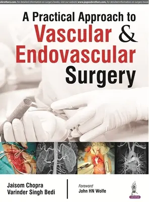 Praktyczne podejście do chirurgii naczyniowej i wewnątrznaczyniowej - A Practical Approach to Vascular & Endovascular Surgery