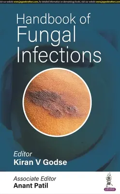 Podręcznik zakażeń grzybiczych - Handbook of Fungal Infections