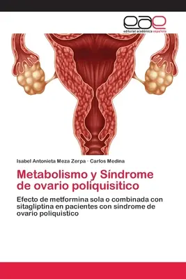 Metabolizm i zespół policystycznych jajników - Metabolismo y Sndrome de ovario poliquisitico