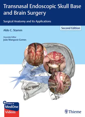 Przeznosowa endoskopowa chirurgia podstawy czaszki i mózgu: Anatomia chirurgiczna i jej zastosowania - Transnasal Endoscopic Skull Base and Brain Surgery: Surgical Anatomy and Its Applications