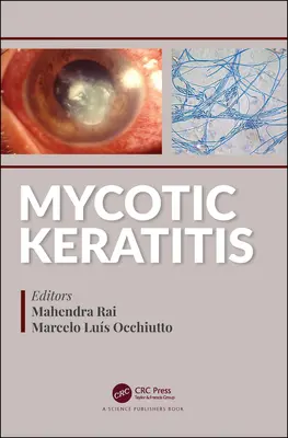 Grzybicze zapalenie rogówki - Mycotic Keratitis