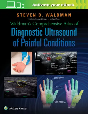 Kompleksowy atlas ultrasonografii diagnostycznej Waldmana w stanach bólowych - Waldman's Comprehensive Atlas of Diagnostic Ultrasound of Painful Conditions