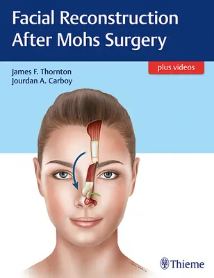 Rekonstrukcja twarzy po operacji Mohsa - Facial Reconstruction After Mohs Surgery