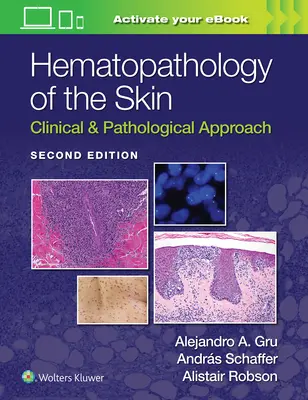 Hematopatologia skóry: Podejście kliniczne i patologiczne - Hematopathology of the Skin: Clinical & Pathological Approach
