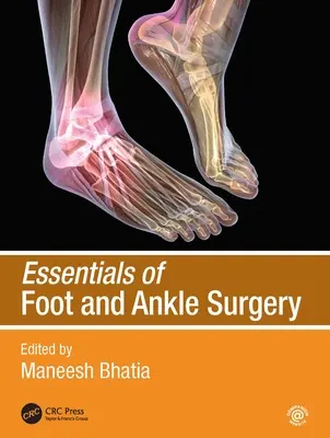 Podstawy chirurgii stopy i stawu skokowego - Essentials of Foot and Ankle Surgery