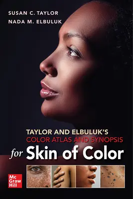 Atlas kolorów Taylora i Elbuluka oraz opis kolorowej skóry - Taylor and Elbuluk's Color Atlas and Synopsis for Skin of Color