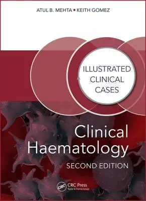 Hematologia kliniczna: Ilustrowane przypadki kliniczne - Clinical Haematology: Illustrated Clinical Cases
