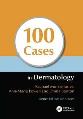 100 przypadków w dermatologii - 100 Cases in Dermatology