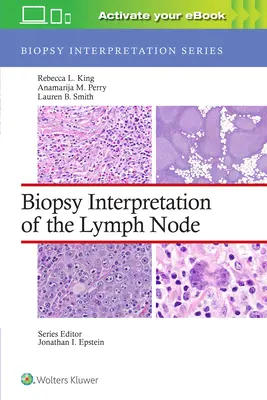 Interpretacja biopsji węzła chłonnego - Biopsy Interpretation of the Lymph Node