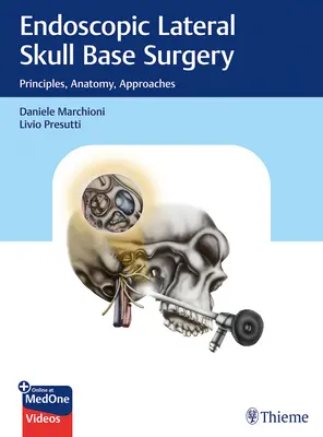 Endoskopowa chirurgia bocznej podstawy czaszki: Zasady, anatomia, podejścia - Endoscopic Lateral Skull Base Surgery: Principles, Anatomy, Approaches