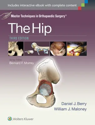 Mistrzowskie techniki w chirurgii ortopedycznej: Biodro - Master Techniques in Orthopaedic Surgery: The Hip