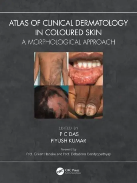 Atlas dermatologii klinicznej skóry kolorowej: Podejście morfologiczne - Atlas of Clinical Dermatology in Coloured Skin: A Morphological Approach