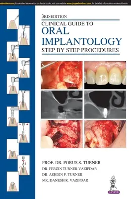 Przewodnik kliniczny po implantologii jamy ustnej: Procedury krok po kroku - Clinical Guide to Oral Implantology: Step by Step Procedures