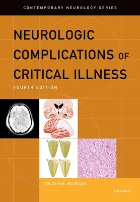 Neurologiczne powikłania krytycznej choroby - Neurologic Complications of Critical Illness