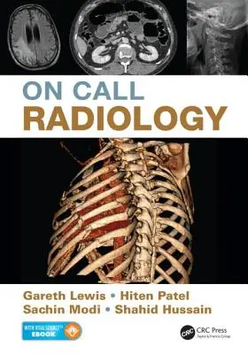 Radiologia na zawołanie - On Call Radiology