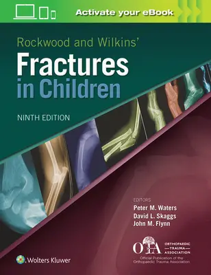 Złamania u dzieci według Rockwooda i Wilkinsa - Rockwood and Wilkins Fractures in Children