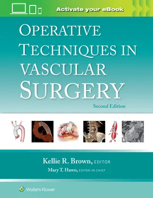 Techniki operacyjne w chirurgii naczyniowej - Operative Techniques in Vascular Surgery