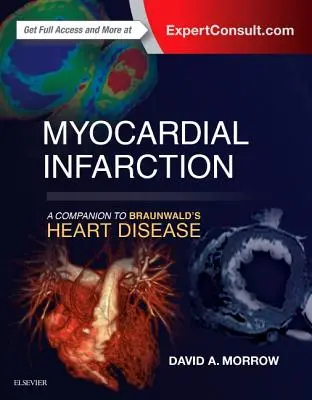 Zawał mięśnia sercowego: A Companion to Braunwald's Heart Disease - Myocardial Infarction: A Companion to Braunwald's Heart Disease