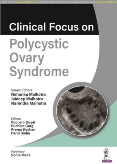 Kliniczne aspekty zespołu policystycznych jajników - Clinical Focus on Polycystic Ovary Syndrome