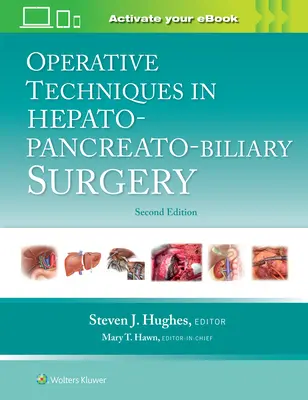 Techniki operacyjne w chirurgii wątroby, trzustki i dróg żółciowych - Operative Techniques in Hepato-Pancreato-Biliary Surgery