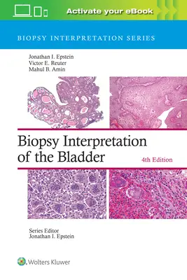 Interpretacja biopsji pęcherza moczowego - Biopsy Interpretation of the Bladder