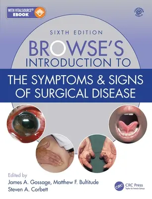 Wprowadzenie Browse'a do objawów i oznak chorób chirurgicznych - Browse's Introduction to the Symptoms & Signs of Surgical Disease