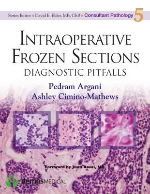 Mrożone sekcje śródoperacyjne: Diagnostyczne pułapki - Intraoperative Frozen Sections: Diagnostic Pitfalls