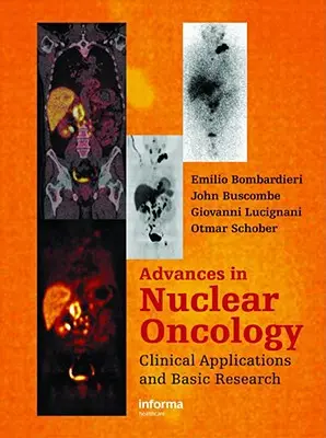 Postępy w onkologii jądrowej:: Diagnoza i terapia - Advances in Nuclear Oncology:: Diagnosis and Therapy