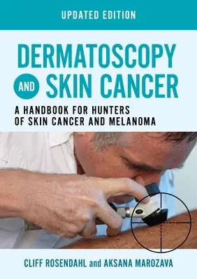 Dermatoskopia i rak skóry, wydanie zaktualizowane - Podręcznik dla łowców raka skóry i czerniaka - Dermatoscopy and Skin Cancer, updated edition - A handbook for hunters of skin cancer and melanoma