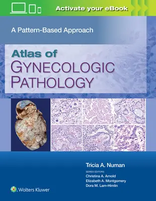 Atlas patologii ginekologicznej: Podejście oparte na wzorcach - Atlas of Gynecologic Pathology: A Pattern-Based Approach