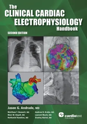 Podręcznik elektrofizjologii klinicznej serca, wydanie drugie - The Clinical Cardiac Electrophysiology Handbook, Second Edition