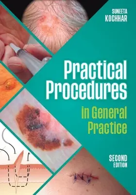 Praktyczne procedury w praktyce ogólnej, wydanie drugie (Kochhar Suneeta (GP in East Sussex)) - Practical Procedures in General Practice, second edition (Kochhar Suneeta (GP in East Sussex))