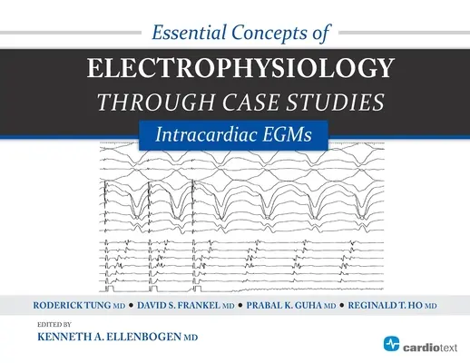 Essential Concepts of Electrophysiology Through Case Studies: Wewnątrzsercowe EGM: Wewnątrzsercowe EGM - Essential Concepts of Electrophysiology Through Case Studies: Intracardiac EGMs: Intracardiac EGMs