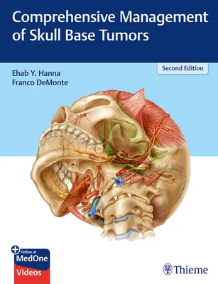 Kompleksowe leczenie guzów podstawy czaszki - Comprehensive Management of Skull Base Tumors