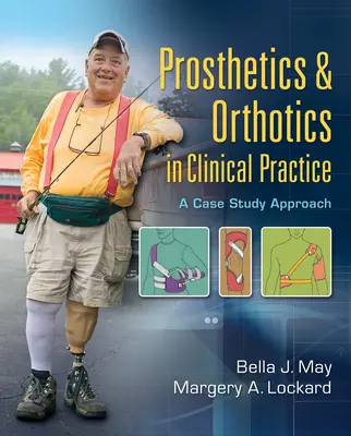 Protetyka i ortotyka w praktyce klinicznej: Podejście oparte na studium przypadku - Prosthetics & Orthotics in Clinical Practice: A Case Study Approach