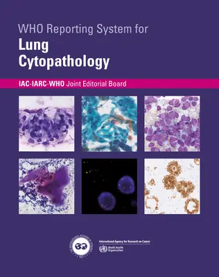 System raportowania cytopatologii płuc - Who Reporting System for Lung Cytopathology