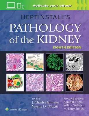 Patologia nerek według Heptinstalla - Heptinstall's Pathology of the Kidney