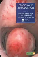 Mięśniaki macicy i reprodukcja - Fibroids and Reproduction