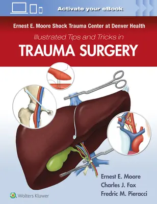 Ernest E. Moore Shock Trauma Center w Denver Health Ilustrowane porady i wskazówki dotyczące chirurgii urazowej - Ernest E. Moore Shock Trauma Center at Denver Health Illustrated Tips and Tricks in Trauma Surgery