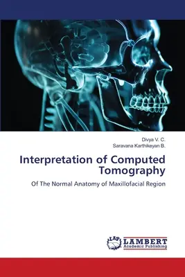 Interpretacja tomografii komputerowej - Interpretation of Computed Tomography