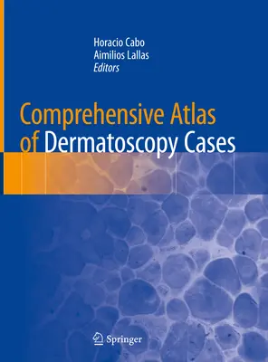 Kompleksowy atlas przypadków dermatoskopii - Comprehensive Atlas of Dermatoscopy Cases