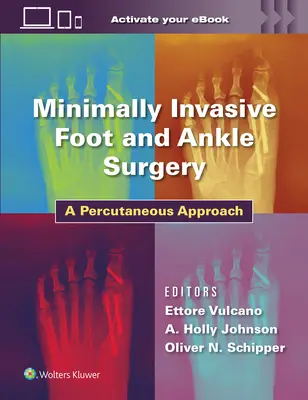 Minimalnie inwazyjna chirurgia stopy i stawu skokowego: Podejście przezskórne - Minimally Invasive Foot and Ankle Surgery: A Percutaneous Approach