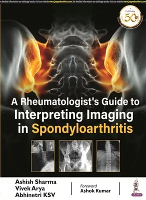 Przewodnik reumatologa po interpretacji badań obrazowych w spondyloartropatii - Rheumatologist's Guide to Interpreting Imaging in Spondyloarthritis