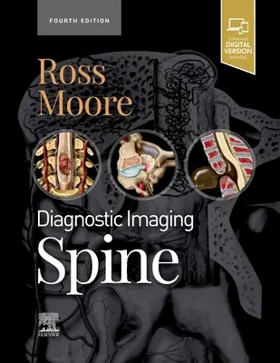 Obrazowanie diagnostyczne: Kręgosłup (Ross Jeffrey S. (profesor radiologii Mayo Clinic College Rochester Minnesota)) - Diagnostic Imaging: Spine (Ross Jeffrey S. (Professor of Radiology Mayo Clinic College Rochester Minnesota))