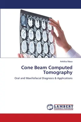 Tomografia komputerowa wiązki stożkowej - Cone Beam Computed Tomography