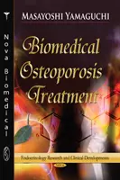 Biomedyczne leczenie osteoporozy - nowy rozwój dzięki funkcjonalnym czynnikom żywnościowym - Biomedical Osteoporosis Treatment - New Development with Functional Food Factors