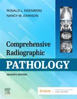 Kompleksowa patologia radiograficzna - Comprehensive Radiographic Pathology