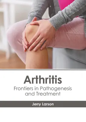 Zapalenie stawów: Granice w patogenezie i leczeniu - Arthritis: Frontiers in Pathogenesis and Treatment