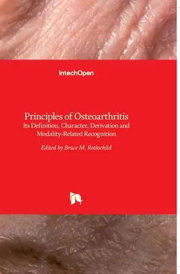 Zasady choroby zwyrodnieniowej stawów: Jego definicja, charakter, pochodne i rozpoznawanie związane z modalnością - Principles of Osteoarthritis: Its Definition, Character, Derivation and Modality-Related Recognition