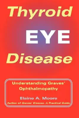 Choroby oczu związane z tarczycą: Zrozumienie oftalmopatii Gravesa-Basedowa - Thyroid Eye Disease: Understanding Graves' Ophthalmopathy